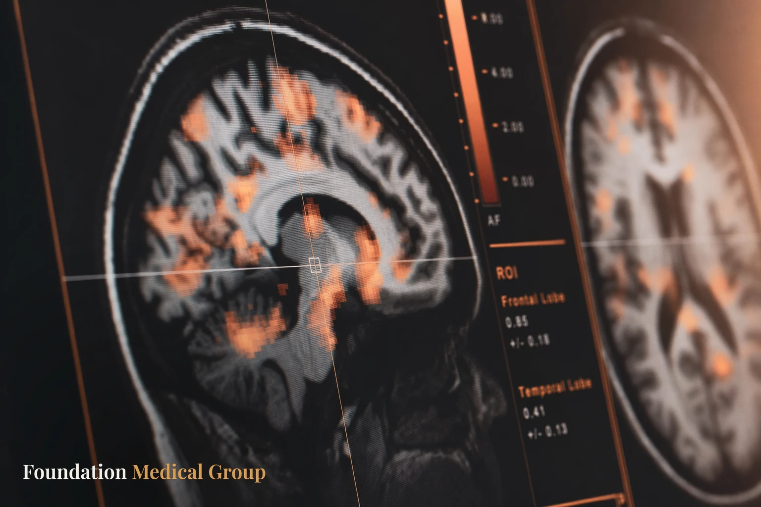 Brain Mapping Texas Advanced EEG and qEEG Clinics